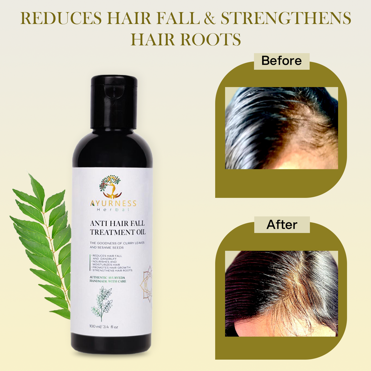 AYURNESS HERBAL ANTI-HAIRFALL TREATMENT OIL- 100 ML